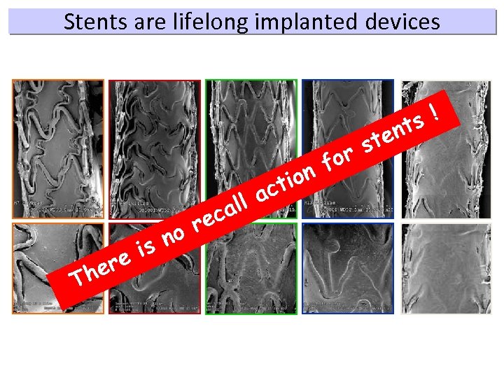 Stents are lifelong implanted devices ion ct r no is ere Th ll a