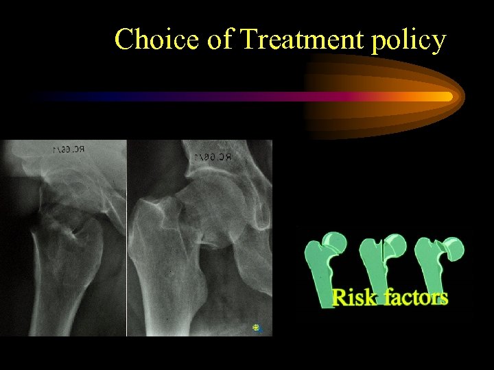 Choice of Treatment policy 