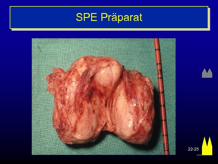 SPE Präparat 22 -25 