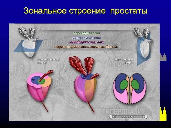 Зональное строение простаты 