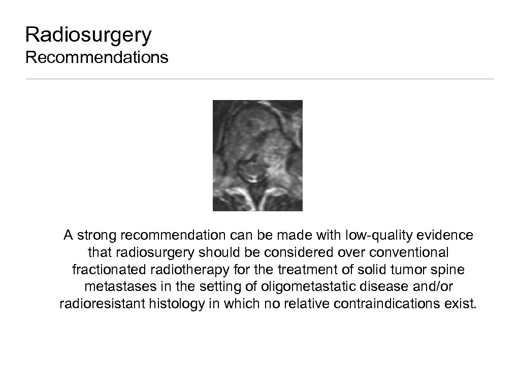 Radiosurgery Recommendations A strong recommendation can be made with low-quality evidence that radiosurgery should