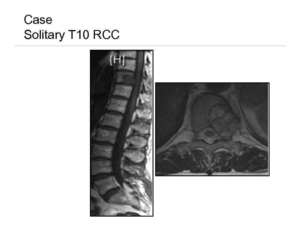 Case Solitary T 10 RCC 