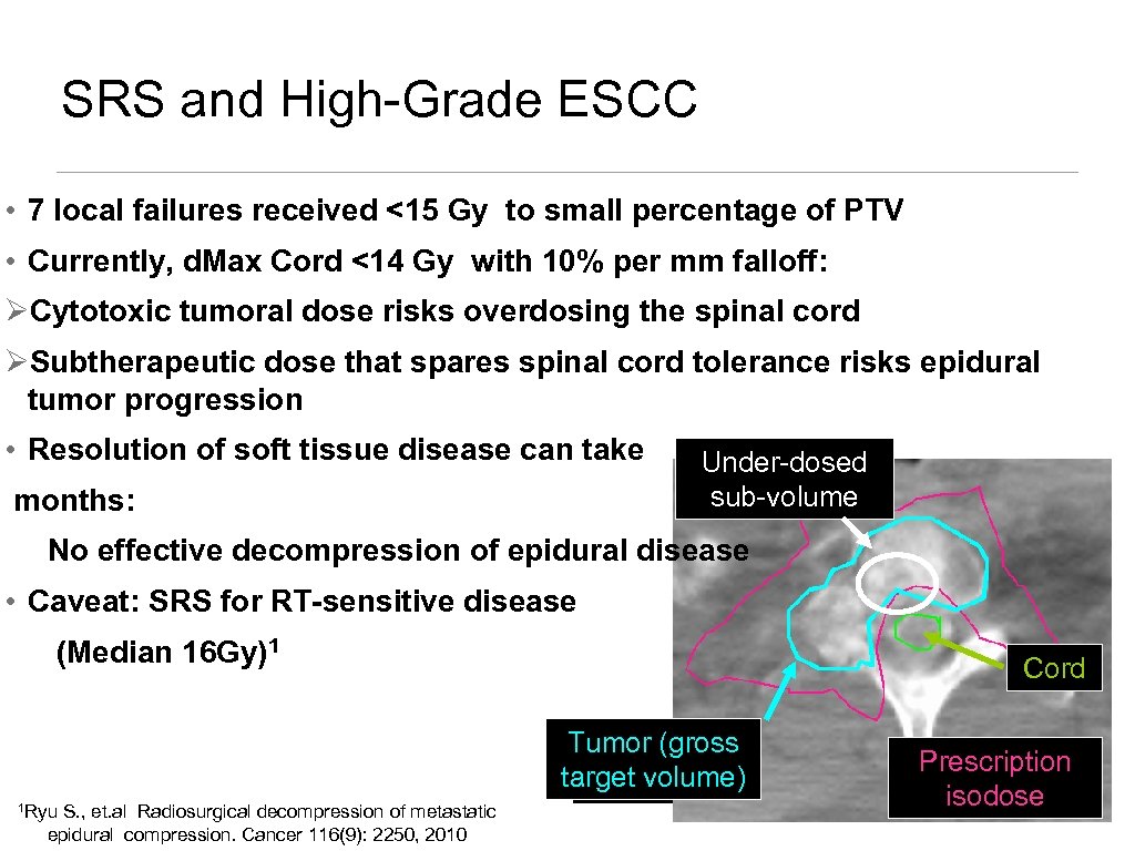 SRS and High-Grade ESCC • 7 local failures received <15 Gy to small percentage