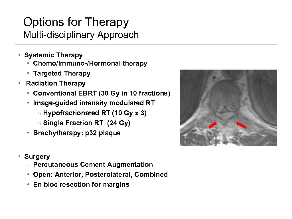 Options for Therapy Multi-disciplinary Approach • Systemic Therapy • Chemo/Immuno-/Hormonal therapy • Targeted Therapy