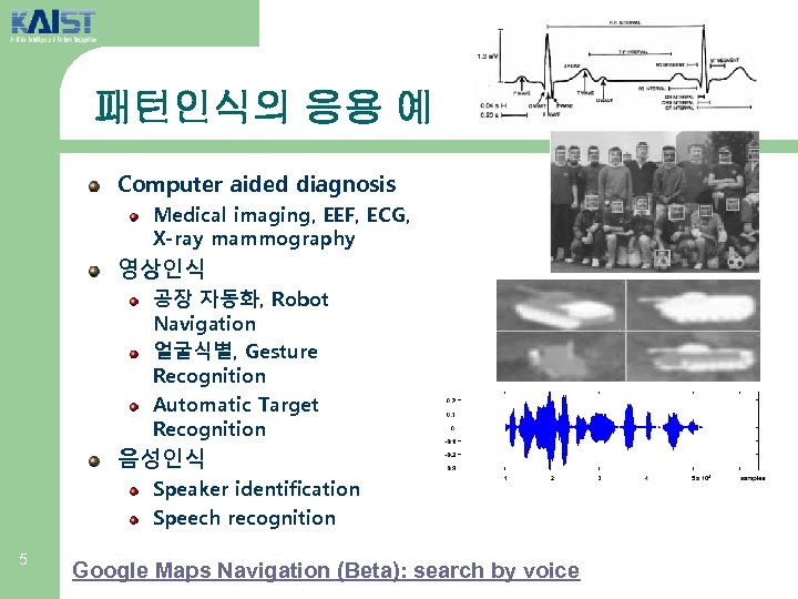 패턴인식의 응용 예 Computer aided diagnosis Medical imaging, EEF, ECG, X-ray mammography 영상인식 공장