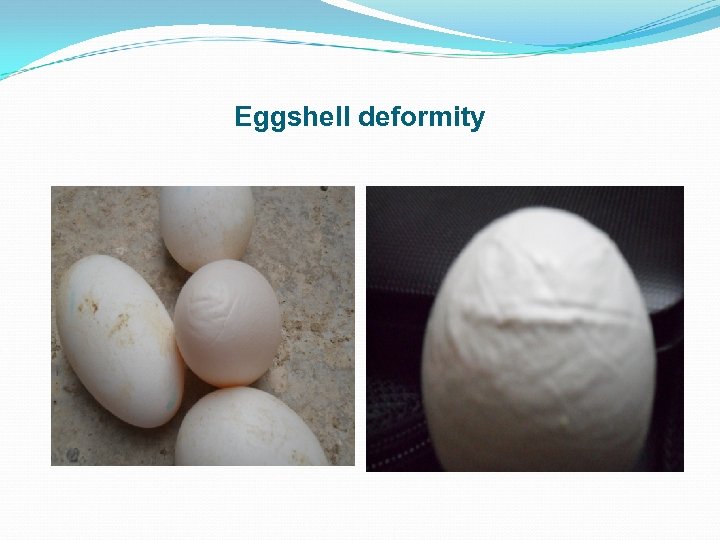 Eggshell deformity 