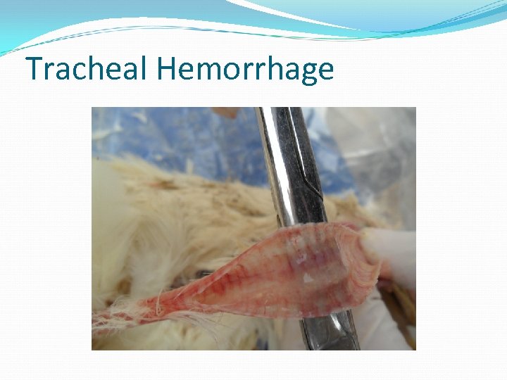 Tracheal Hemorrhage 