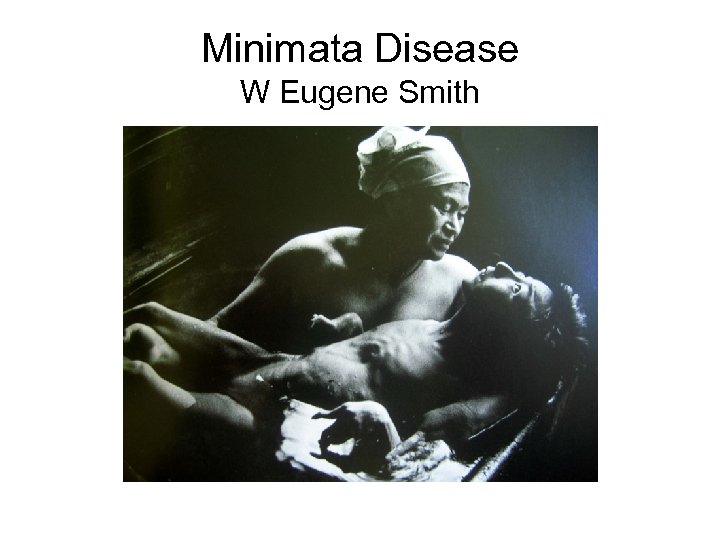 Minimata Disease W Eugene Smith 