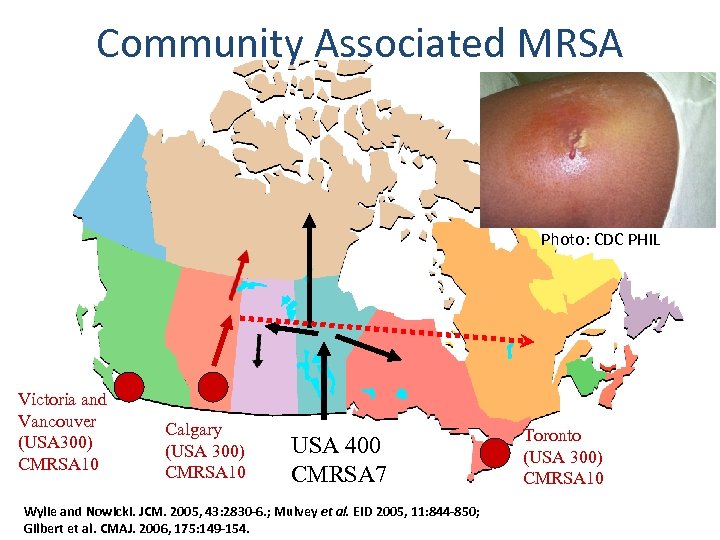 Community Associated MRSA Photo: CDC PHIL Victoria and Vancouver (USA 300) CMRSA 10 Calgary