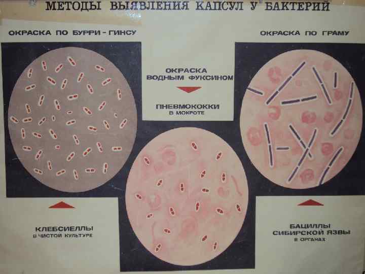Окраска спор бактерий. Метод Бурри Гинса. Капсула бактерий окраска по Бурри-ГИНСУ. Способ выявления капсул у бактерий. Методы обнаружения капсулы бактерий.