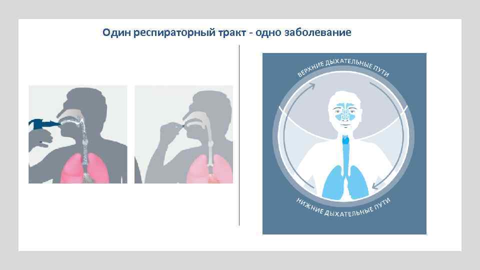 Один респираторный тракт - одно заболевание 