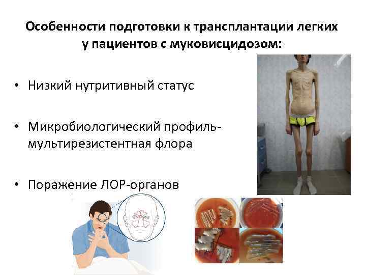 Особенности подготовки к трансплантации легких у пациентов с муковисцидозом: • Низкий нутритивный статус •