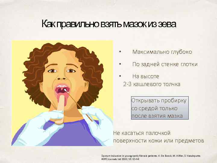 Как правильно взять мазок из зева • Максимально глубоко • По задней стенке глотки