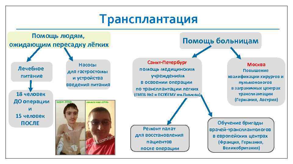 Трансплантация Помощь людям, ожидающим пересадку лёгких Лечебное питание 18 человек ДО операции и 15