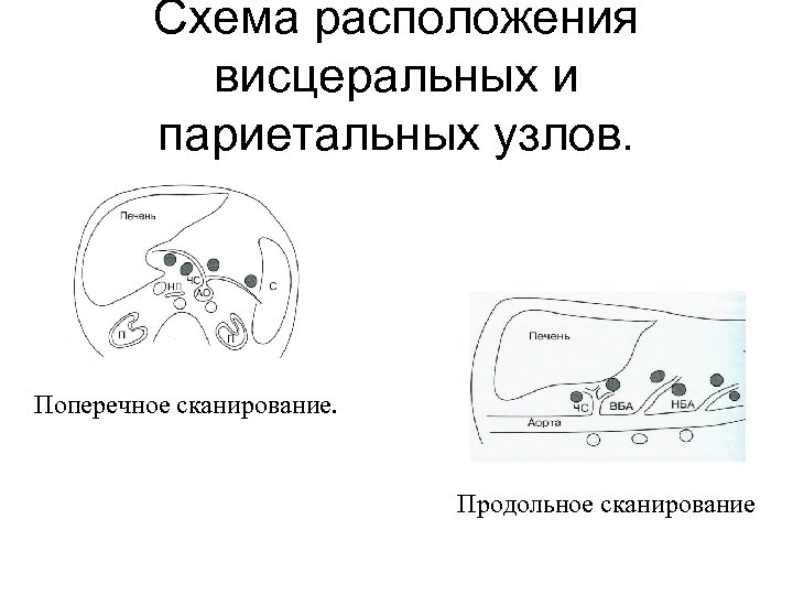 Схема расположения висцеральных и париетальных узлов. Поперечное сканирование. Продольное сканирование 