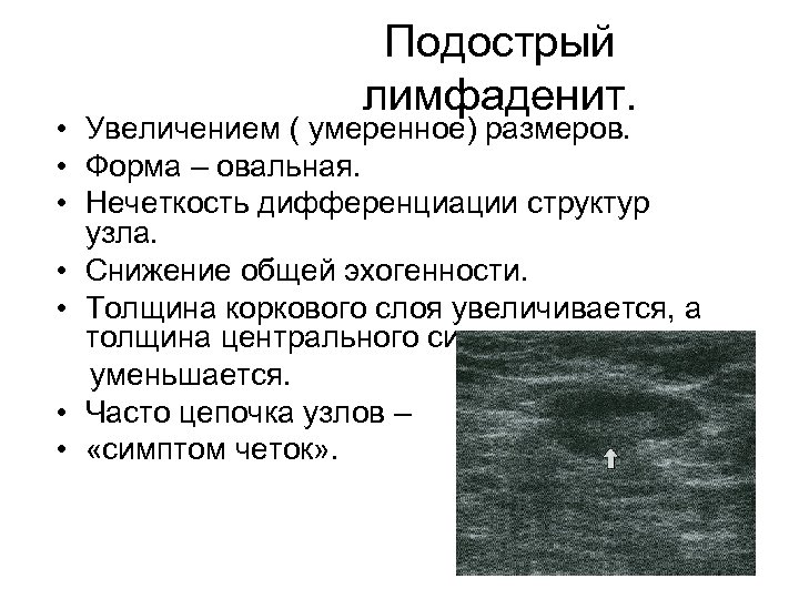 Лимфаденит мкб. Лимфаденит УЗИ признаки. Дифференцировка структуры лимфоузлов. Сниженная эхогенность лимфоузлов что это.