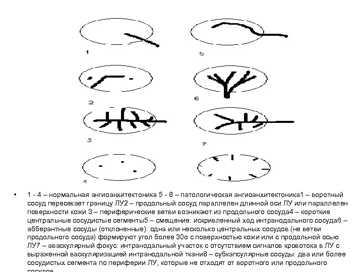  • 1 - 4 – нормальная ангиоанхитектоника 5 - 8 – патологическая ангиоанхитектоника