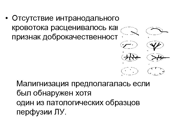  • Отсутствие интранодального кровотока расценивалось как признак доброкачественности. Малигнизация предполагалась если был обнаружен