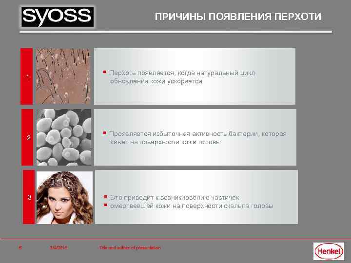 ПРИЧИНЫ ПОЯВЛЕНИЯ ПЕРХОТИ 1 2 3 § Перхоть появляется, когда натуральный цикл обновления кожи