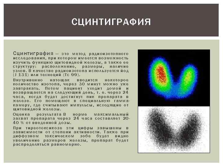 СЦИНТИГРАФИЯ Сцинтиграфия — это метод радиоизотопного исследования, при котором имеется возможность изучить функцию щитовидной