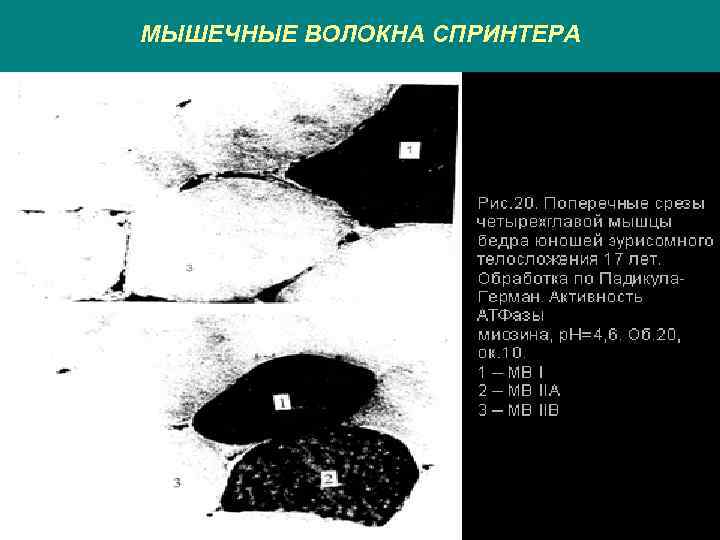 МЫШЕЧНЫЕ ВОЛОКНА СПРИНТЕРА 