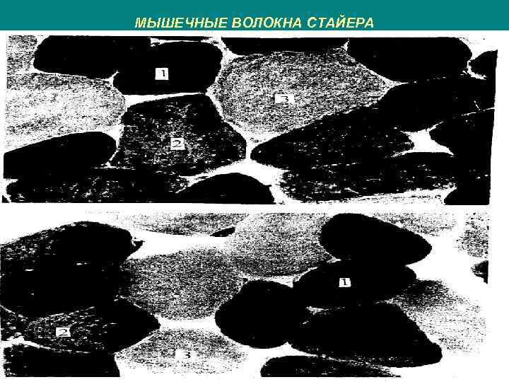 МЫШЕЧНЫЕ ВОЛОКНА СТАЙЕРА 