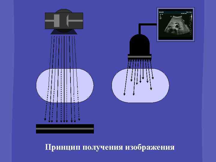 Принцип получения изображения 