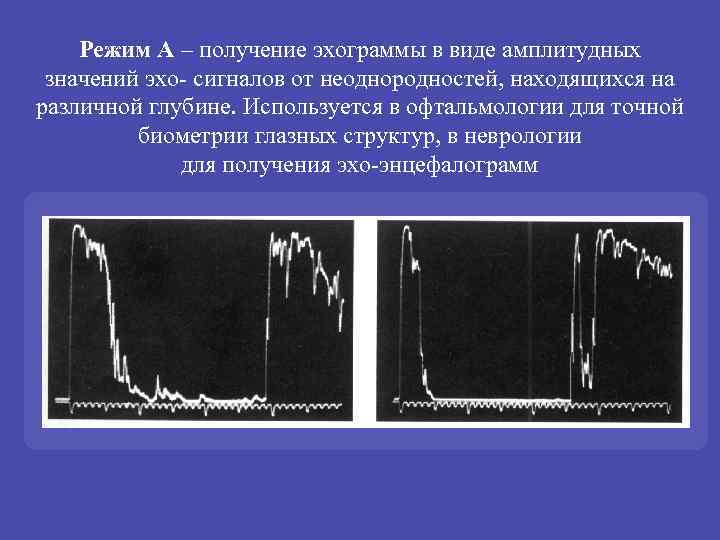 Режим А – получение эхограммы в виде амплитудных значений эхо- сигналов от неоднородностей, находящихся