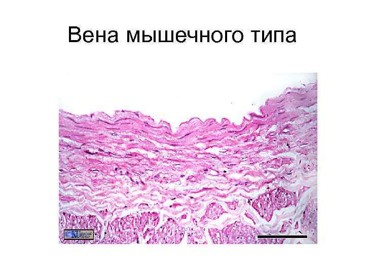 Вена мышечного типа 