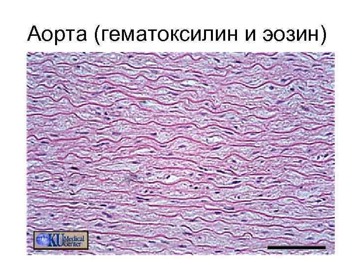 Аорта (гематоксилин и эозин) 