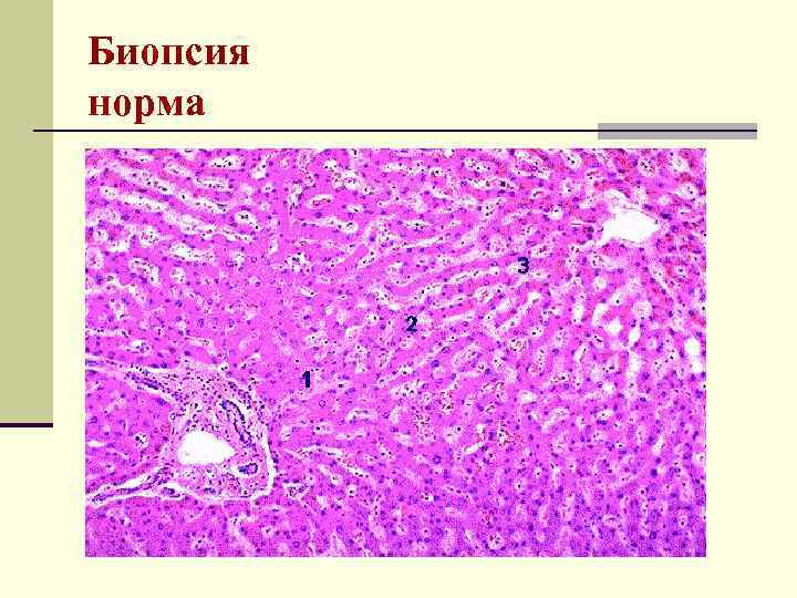 Биопсия норма 