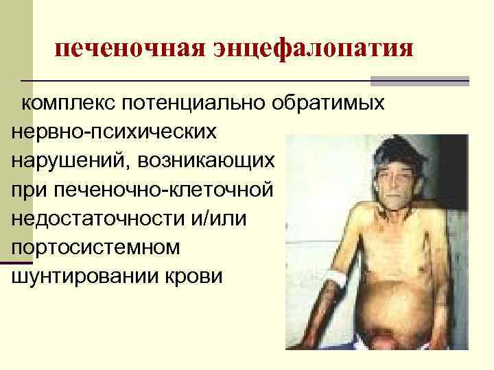 печеночная энцефалопатия комплекс потенциально обратимых нервно-психических нарушений, возникающих при печеночно-клеточной недостаточности и/или портосистемном шунтировании