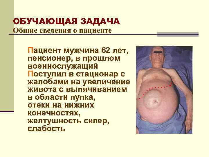 ОБУЧАЮЩАЯ ЗАДАЧА Общие сведения о пациенте Пациент мужчина 62 лет, пенсионер, в прошлом военнослужащий