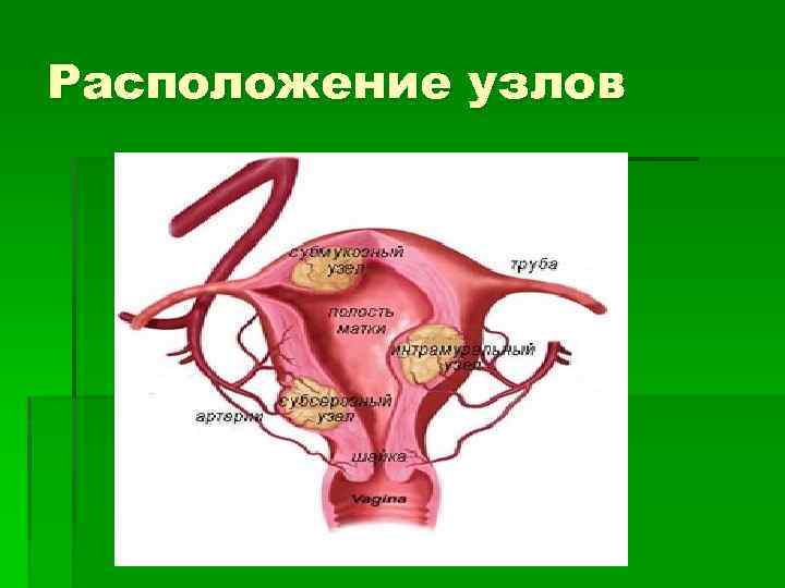 Расположение узлов 