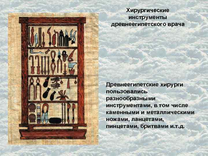 Хирургические инструменты древнеегипетского врача Древнеегипетские хирурги пользовались разнообразными инструментами, в том числе каменными и