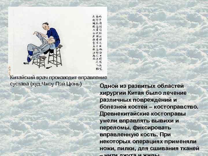 Китайский врач производит вправление сустава (худ. Чжоу Пэй Цюнь) Одной из развитых областей хирургии