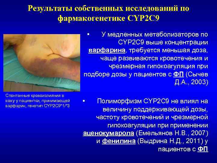 Результаты собственных исследований по фармакогенетике CYP 2 С 9 • У медленных метаболизаторов по