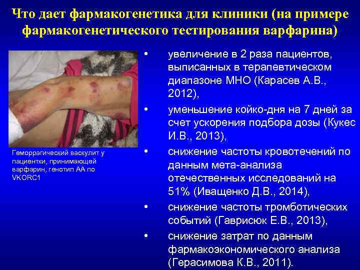 Что дает фармакогенетика для клиники (на примере фармакогенетического тестирования варфарина) • • Геморрагический васкулит