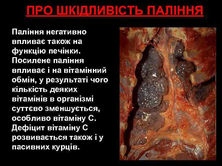 ПРО ШКІДЛИВІСТЬ ПАЛІННЯ Паління негативно впливає також на функцію печінки. Посилене паління впливає і