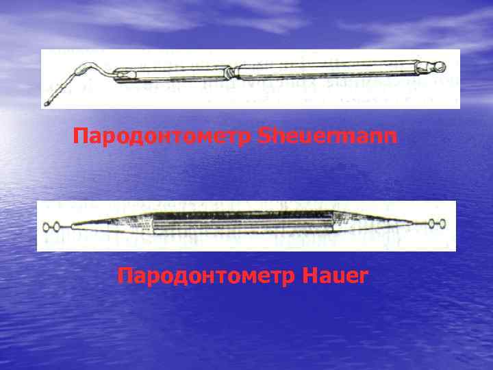 Пародонтометр Sheuermann Пародонтометр Hauer 