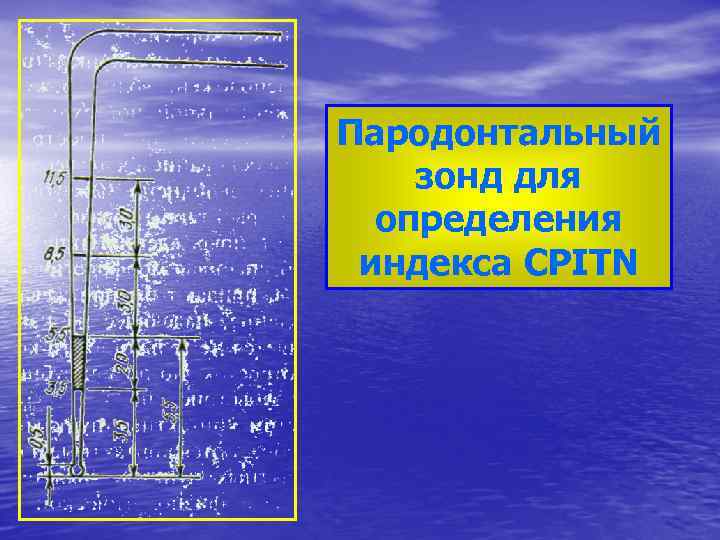Пародонтальный зонд для определения индекса CPITN 