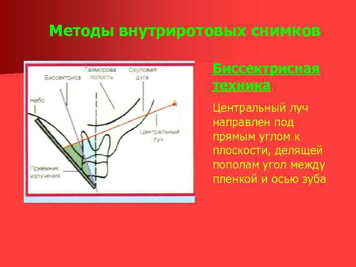 Методы внутриротовых снимков Биссектрисная техника Центральный луч направлен под прямым углом к плоскости, делящей