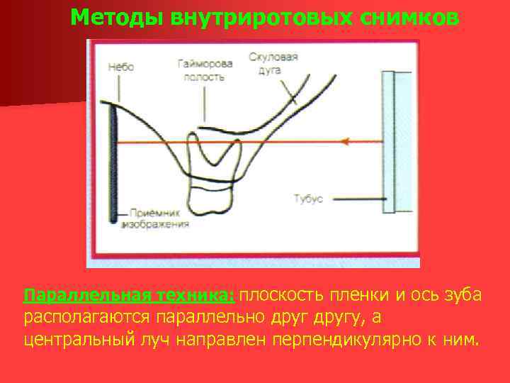 Методы внутриротовых снимков Параллельная техника: плоскость пленки и ось зуба располагаются параллельно другу, а