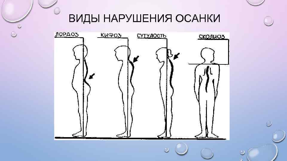 Коррекция осанки и телосложения презентация