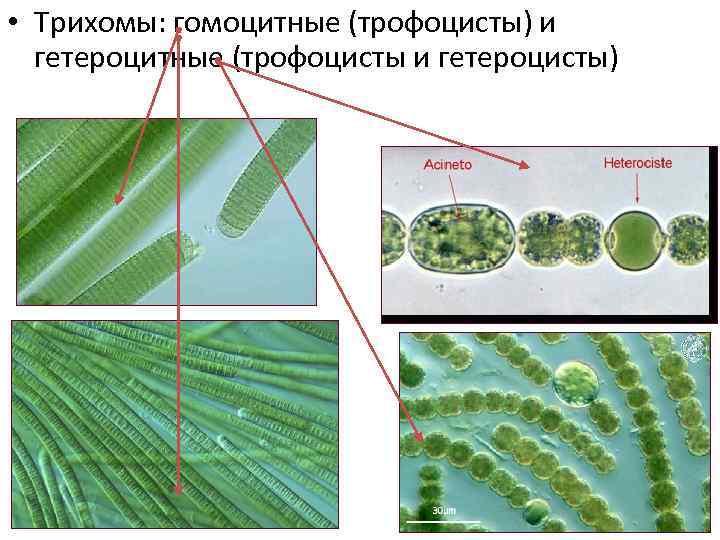  • Трихомы: гомоцитные (трофоцисты) и гетероцитные (трофоцисты и гетероцисты) 