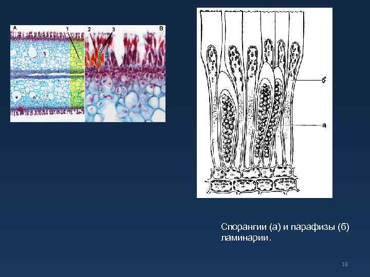 Спорангии (а) и парафизы (б) ламинарии. 18 