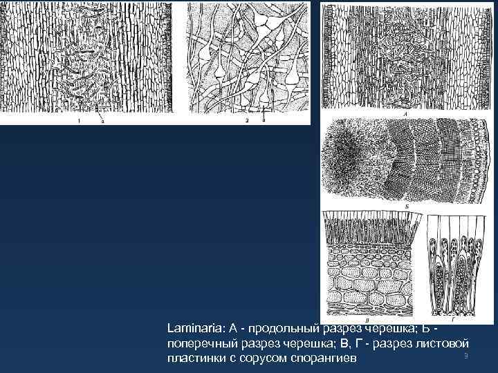 Laminariа: А - продольный разрез черешка; Б поперечный разрез черешка; В, Г - разрез