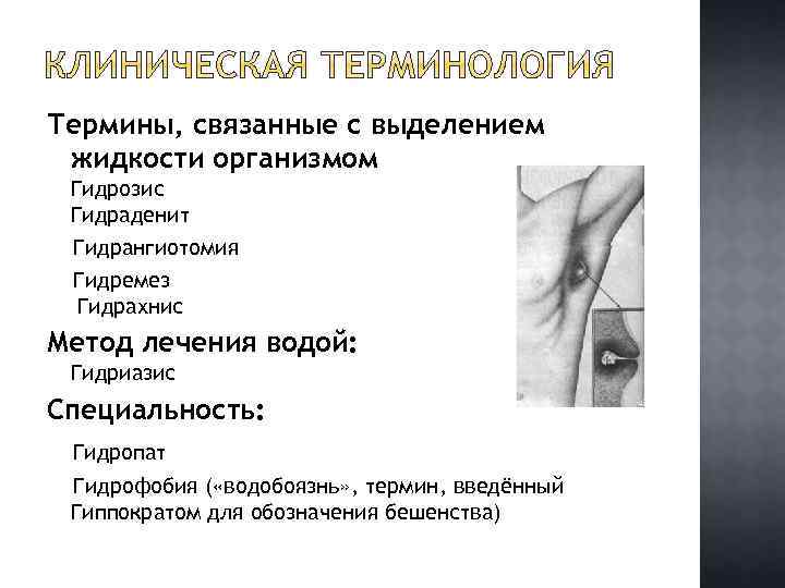 Термины, связанные с выделением жидкости организмом Гидрозис Гидраденит Гидрангиотомия Гидремез Гидрахнис Метод лечения водой: