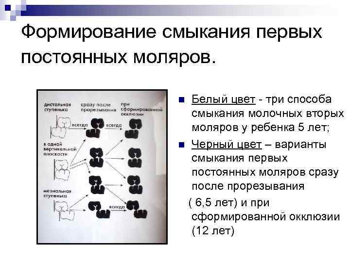 Формирование смыкания первых постоянных моляров. Белый цвет - три способа смыкания молочных вторых моляров