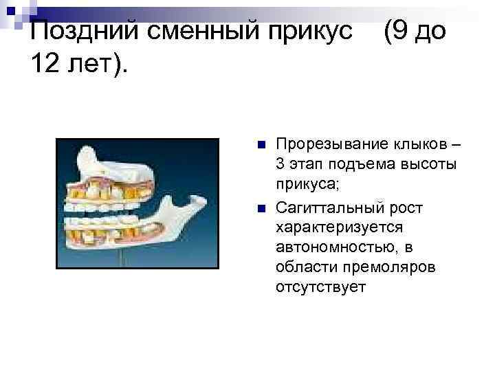 Поздний сменный прикус 12 лет). n n (9 до Прорезывание клыков – 3 этап